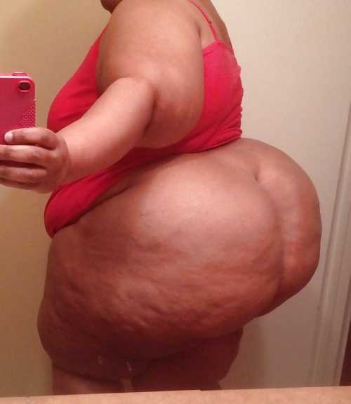 Stretch Marks and Cellulite